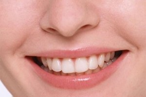 Белые зубы - это реально? Белые зубы - это реально?