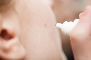 Как избавиться от прыщей - советы народной медицины Как избавиться от прыщей - советы народной медицины