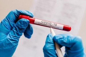 Что такое тестирование на антитела к COVID-19? Что такое тестирование на антитела к COVID-19?